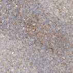 Immunohistochemical staining of human tonsil shows moderate membranous positivity in non-germinal center cells.