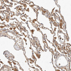 Immunohistochemical staining of human lung shows moderate cytoplasmic positivity in macrophages.