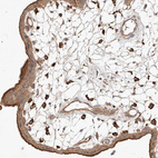 Immunohistochemical staining of human placenta shows moderate cytoplasmic positivity in trophoblastic cells.