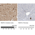 Anti-REEP2 Antibody