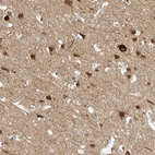 Immunohistochemical staining of human cerebral cortex shows high expression.