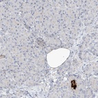 Anti-REEP2 Antibody