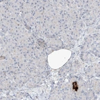 Immunohistochemical staining of human pancreas shows low expression as expected.
