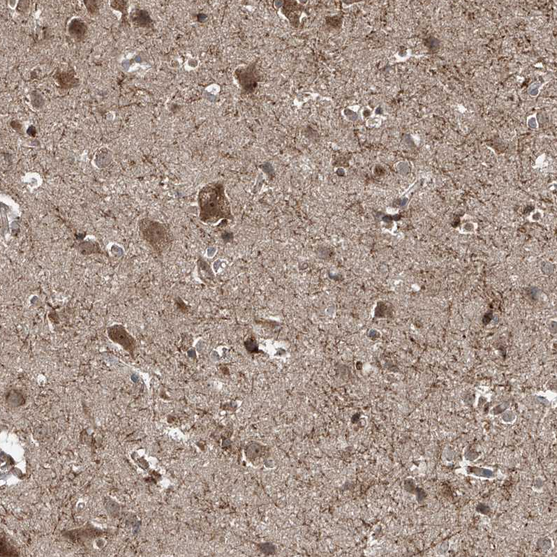 Anti-ZDHHC9 Antibody