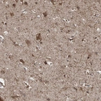 Anti-ZDHHC9 Antibody