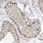 Anti-AURKAIP1 Antibody