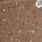 Immunohistochemical staining of human cerebral cortex shows moderate cytoplasmic positivity in neuronal cells.