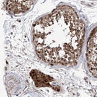 Immunohistochemical staining of human testis shows moderate to strong cytoplasmic positivity in Leydig cells.