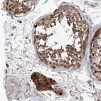 Immunohistochemical staining of human testis shows moderate to strong cytoplasmic positivity in Leydig cells.