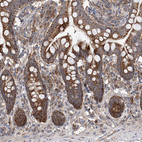 Immunohistochemical staining of human small intestine shows moderate to strong cytoplasmic positivity in glandular cells.