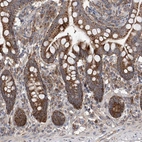 Immunohistochemical staining of human small intestine shows moderate to strong cytoplasmic positivity in glandular cells.