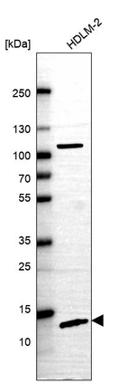Western blot analysis in human cell line HDLM-2.