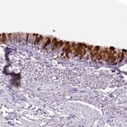 Anti-SCGB1A1 Antibody