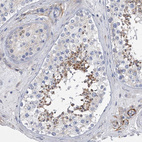 Immunohistochemical staining of human testis shows moderate cytoplasmic positivity in spermatids.