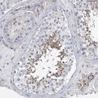 Immunohistochemical staining of human testis shows moderate cytoplasmic positivity in spermatids.