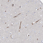 Immunohistochemical staining of human cerebral cortex shows strong cytoplasmic positivity in endothelial cells.