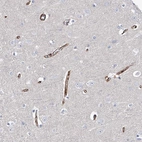 Immunohistochemical staining of human cerebral cortex shows strong cytoplasmic positivity in endothelial cells.