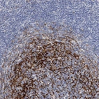 Immunohistochemical staining of human tonsil shows strong cytoplasmic positivity in germinal center cells.