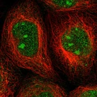 Immunofluorescent staining of human cell line A-431 shows localization to nucleus & nucleoli.