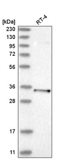 Western blot analysis in human cell line RT-4.