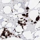 Immunohistochemical staining of human bone marrow shows high expression.