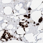 Immunohistochemical staining of human bone marrow shows high expression.