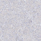 Immunohistochemical staining of human pancreas shows low expression as expected.