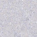 Immunohistochemical staining of human pancreas shows low expression as expected.