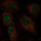 Immunofluorescent staining of human cell line A549 shows localization to nucleus.