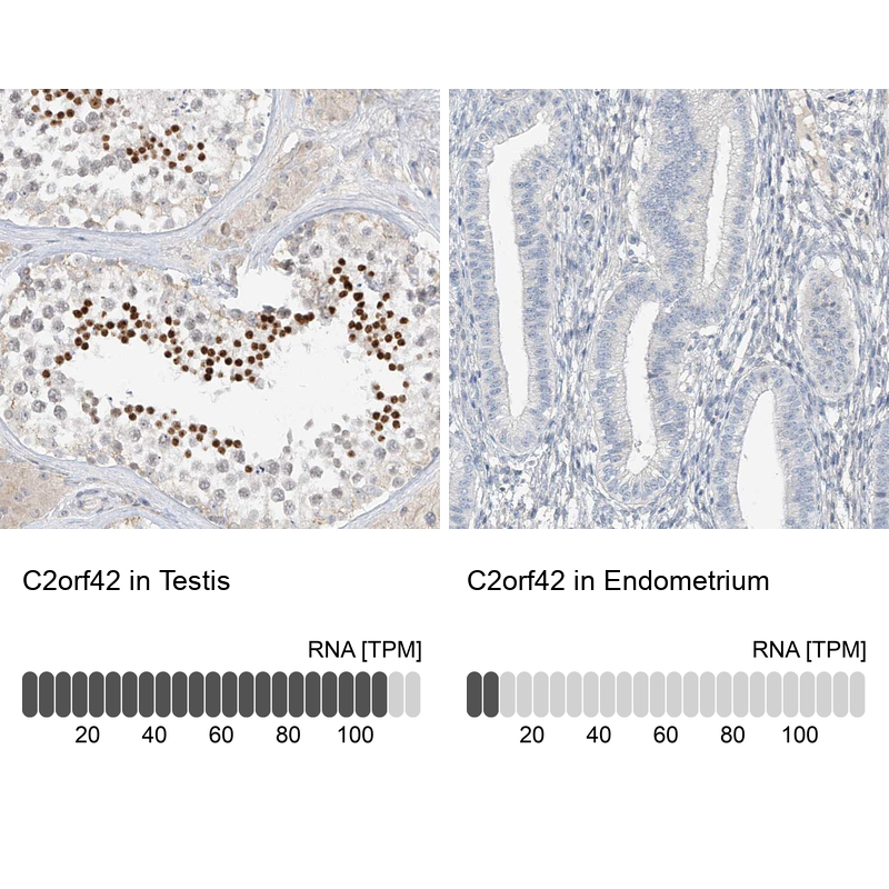 Anti-C2orf42 Antibody