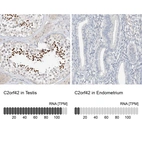 Anti-C2orf42 Antibody