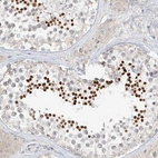 Immunohistochemical staining of human testis shows high expression.