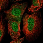 Immunofluorescent staining of human cell line U-2 OS shows localization to nucleoplasm & nuclear membrane.