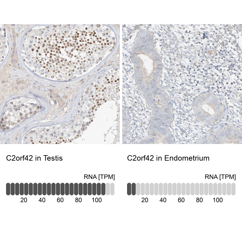Anti-C2orf42 Antibody