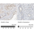 Anti-C2orf42 Antibody