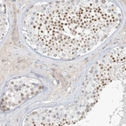 Immunohistochemical staining of human testis shows high expression.