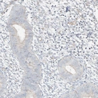 Immunohistochemical staining of human endometrium shows low expression as expected.