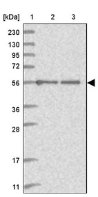 Lane 1: Marker [kDa] 230, 130, 95, 72, 56, 36, 28, 17, 11_br/_Lane 2: Human cell line RT-4_br/_Lane 3: Human cell line U-251MG sp