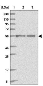Lane 1: Marker [kDa] 230, 130, 95, 72, 56, 36, 28, 17, 11_br/_Lane 2: Human cell line RT-4_br/_Lane 3: Human cell line U-251MG sp
