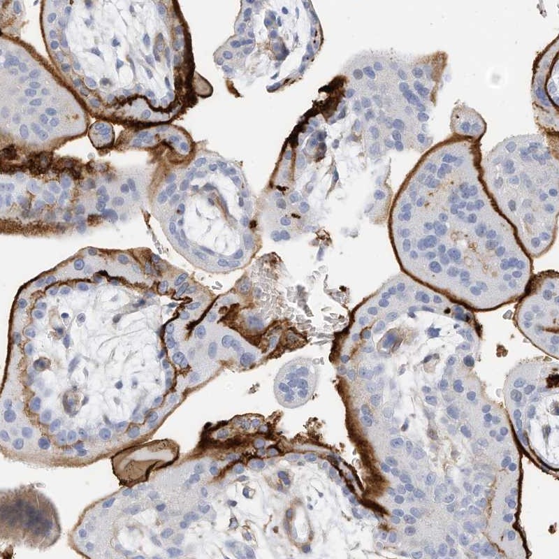Anti-TXNDC9 Antibody