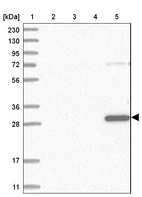 Lane 1: Marker [kDa] 230, 130, 95, 72, 56, 36, 28, 17, 11_br/_Lane 2: Human cell line RT-4_br/_Lane 3: Human cell line U-251MG sp_br/_Lane 4: Human plasma (IgG/HSA depleted)_br/_Lane 5: Human liver tissue