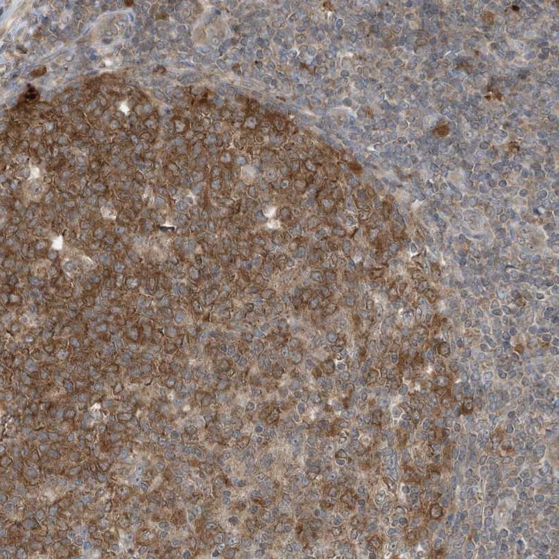 Anti-TXNDC9 Antibody