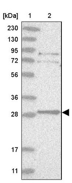 Anti-TXNDC9 Antibody