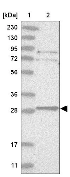 Lane 1: Marker [kDa] 230, 130, 95, 72, 56, 36, 28, 17, 11_br/_Lane 2: Human cell line RT-4