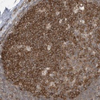 Anti-TXNDC9 Antibody