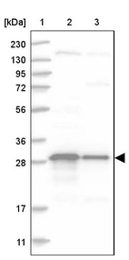 Lane 1: Marker [kDa] 230, 130, 95, 72, 56, 36, 28, 17, 11_br/_Lane 2: Human cell line RT-4_br/_Lane 3: Human cell line U-251MG sp
