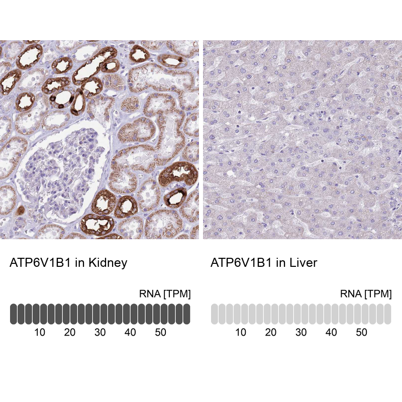 Anti-ATP6V1B1 Antibody