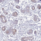 Immunohistochemical staining of human breast shows moderate cytoplasmic positivity in glandular cells.