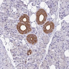 Immunohistochemical staining of human salivary gland shows strong cytoplasmic positivity in ductal cells.