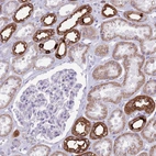 Immunohistochemical staining of human kidney shows moderate to strong cytoplasmic positivity in cells in distal tubules.